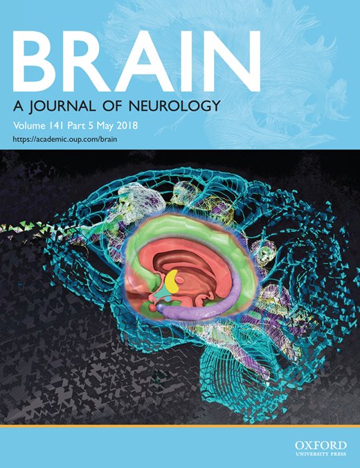 Our Research Assistant Hasan Duymuş’s Article Published in Brain Journal