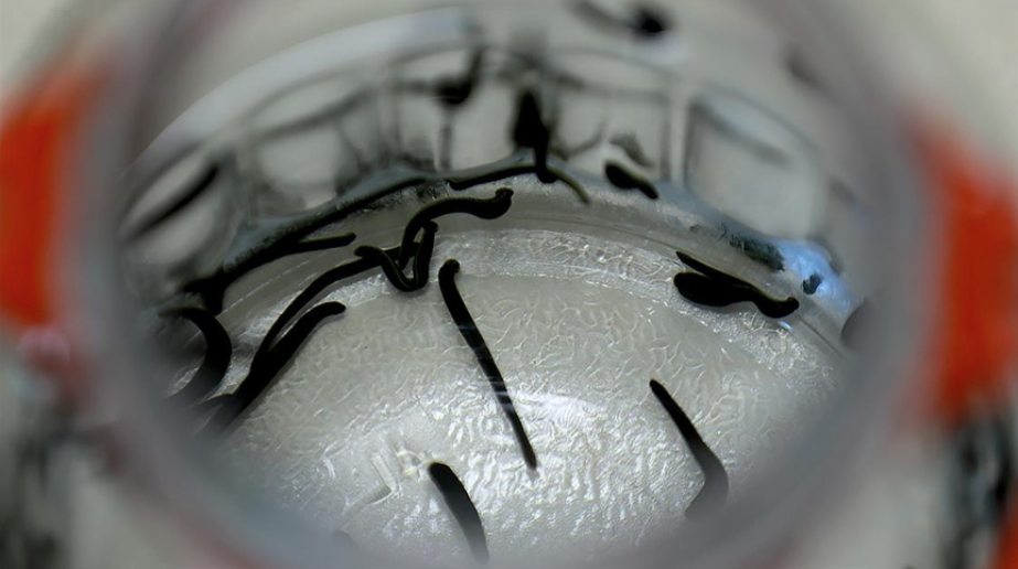 Sülük Salgısıyla İltihaplı ve Otoimmün Hastalıklarda Alternatif Tedavi